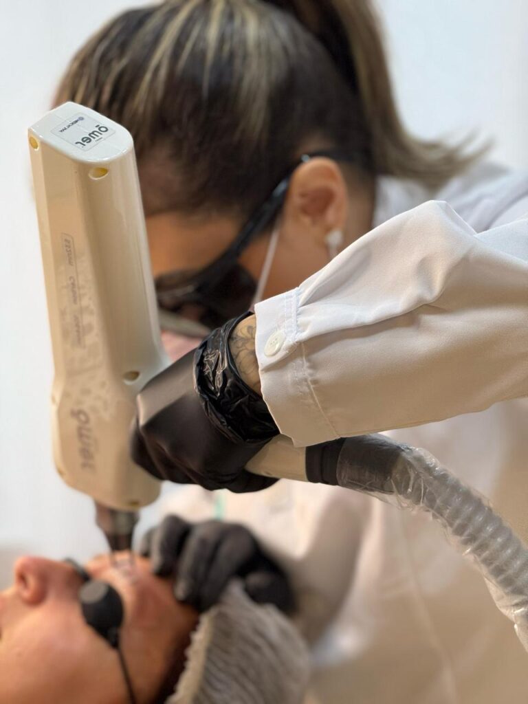 Remoção de Tatuagem e Micropigmentação​ - Anna Martini