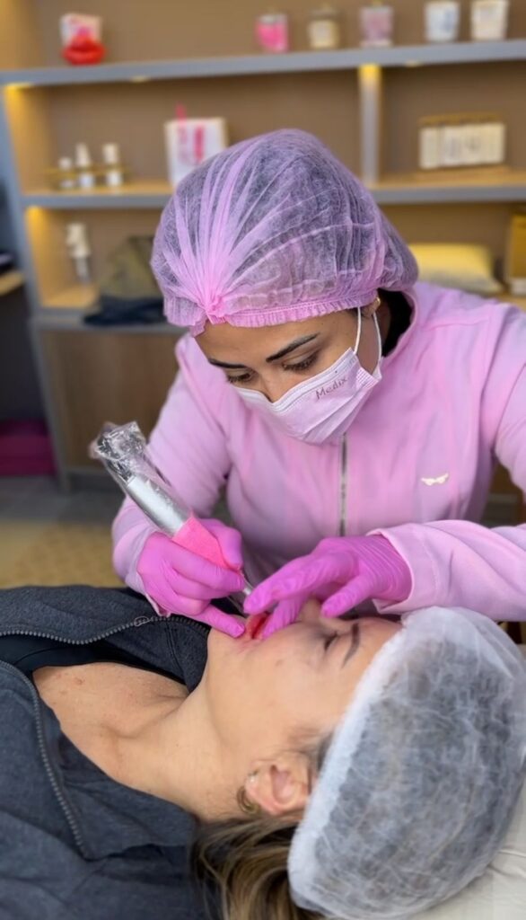 Revitalização Labial - Anna Martini